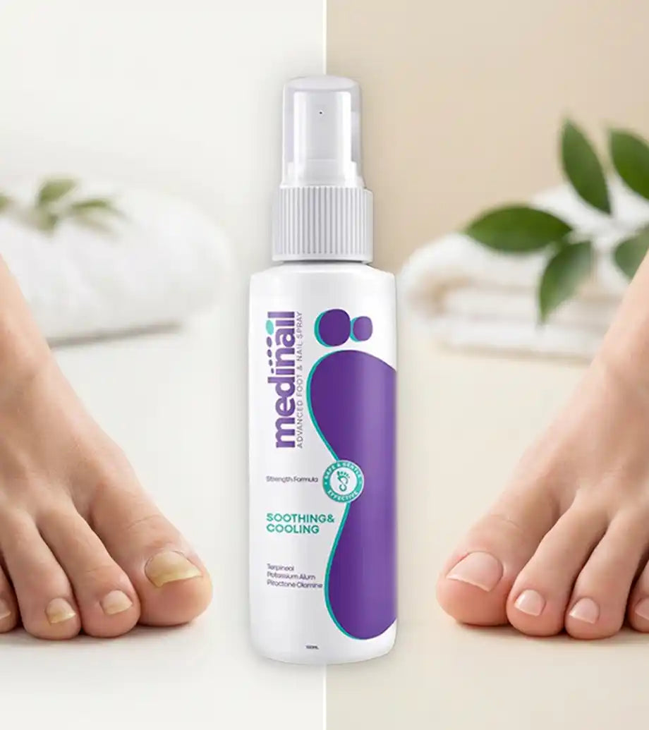 Medinail® Elimina los hongos de tus uñas